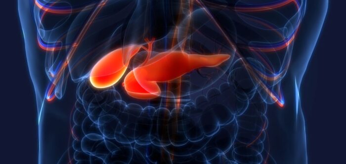Next Steps for Novel Treatment Combination in Pancreatic Cancer